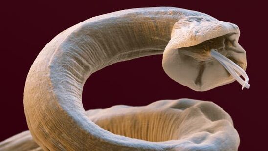 Parasiten an enger Persoun