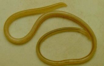 Aarte vu Parasiten am mënschleche Kierper