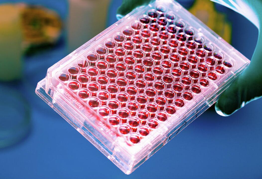 Blutt Test fir Parasiten