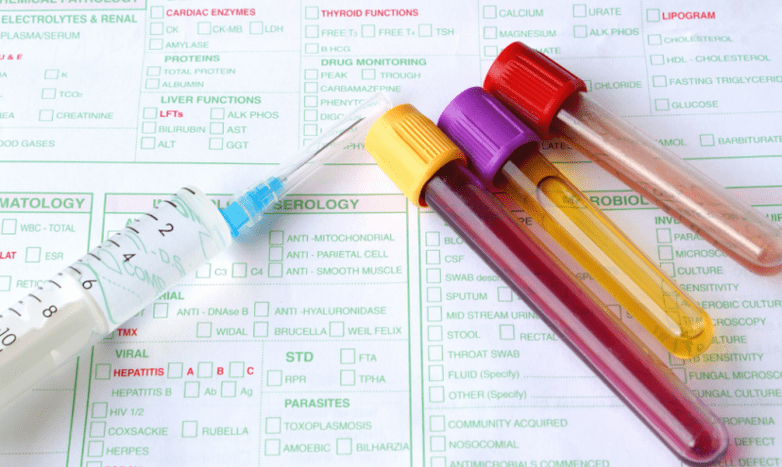 diagnostesch Optiounen fir Parasiten am Kierper