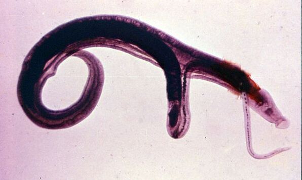 Schistosome sinn ee vun den heefegsten a geféierlechste Parasiten